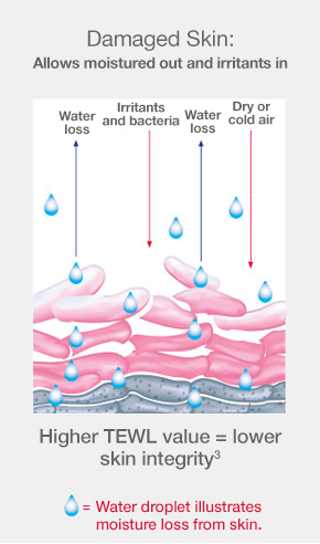 Unhealthy skin